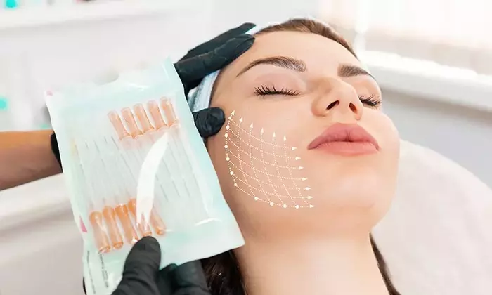 Thread Lift (Facial Thread Lifting)